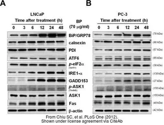 Anti-ASK1 antibody [C2C3-2], C-term used in Western Blot (WB). GTX107921