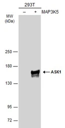 Anti-ASK1 antibody [C2C3-2], C-term used in Western Blot (WB). GTX107921