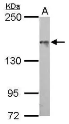 Anti-ASK1 antibody [C2C3-2], C-term used in Western Blot (WB). GTX107921