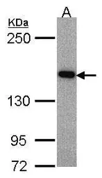 Anti-ASK1 antibody [C2C3-2], C-term used in Western Blot (WB). GTX107921