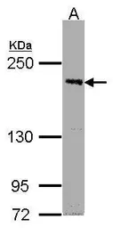 Anti-PASK antibody [C2C3], C-term used in Western Blot (WB). GTX107932