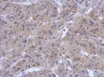 Anti-ZAP70 antibody used in IHC (Paraffin sections) (IHC-P). GTX107950