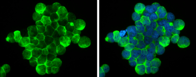 Anti-ZAP70 antibody used in Immunocytochemistry/ Immunofluorescence (ICC/IF). GTX107950