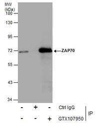 Anti-ZAP70 antibody used in Immunoprecipitation (IP). GTX107950