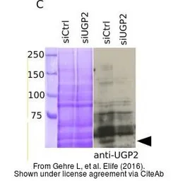 Anti-UGP2 antibody [N3C3-2] used in Western Blot (WB). GTX107967