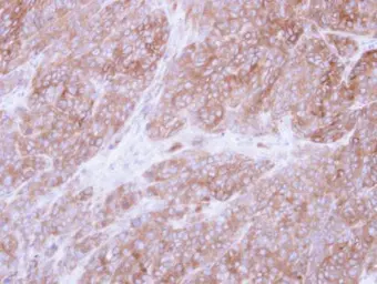 Anti-UGP2 antibody [N3C3-2] used in IHC (Paraffin sections) (IHC-P). GTX107967