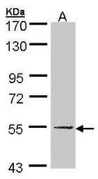 Anti-UGP2 antibody [N3C3-2] used in Western Blot (WB). GTX107967