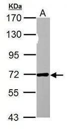 Anti-Nucleoporin p62 antibody used in Western Blot (WB). GTX107973