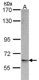 Anti-ARFGAP3 antibody [C3], C-term used in Western Blot (WB). GTX107999