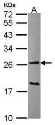 Anti-GSTA1 antibody used in Western Blot (WB). GTX108012