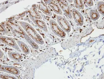 Anti-RBP1 antibody used in IHC (Paraffin sections) (IHC-P). GTX108016