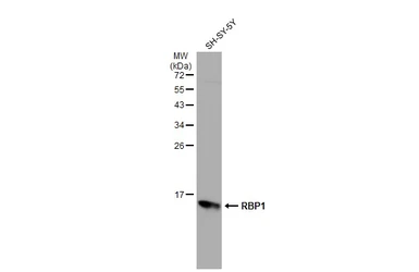 Anti-RBP1 antibody used in Western Blot (WB). GTX108016