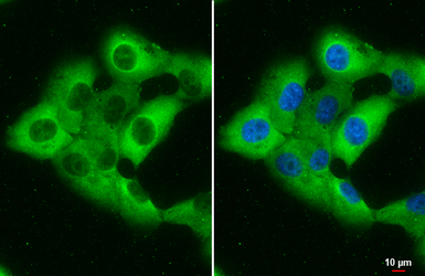 Anti-RBP1 antibody used in Immunocytochemistry/ Immunofluorescence (ICC/IF). GTX108016