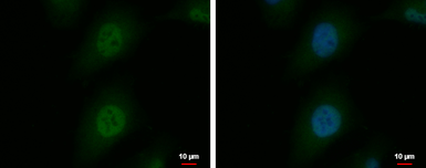 Anti-Snurportin 1 antibody [C2C3], C-term used in Immunocytochemistry/ Immunofluorescence (ICC/IF). GTX108022