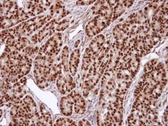 Anti-Snurportin 1 antibody [C2C3], C-term used in IHC (Paraffin sections) (IHC-P). GTX108022