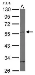 Anti-ROR beta antibody used in Western Blot (WB). GTX108148