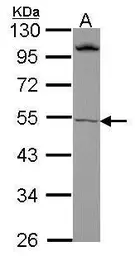 Anti-ROR beta antibody used in Western Blot (WB). GTX108148