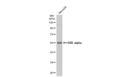 Anti-ERR alpha antibody [N1], N-term used in Western Blot (WB). GTX108166