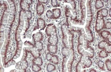 Anti-ERR alpha antibody [N1], N-term used in IHC (Paraffin sections) (IHC-P). GTX108166