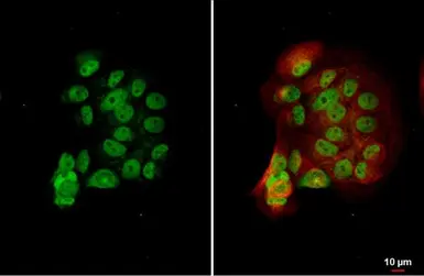 Anti-ERR alpha antibody [N1], N-term used in Immunocytochemistry/ Immunofluorescence (ICC/IF). GTX108166