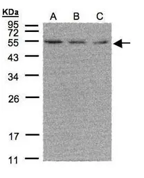 Anti-ERR alpha antibody [N1], N-term used in Western Blot (WB). GTX108166