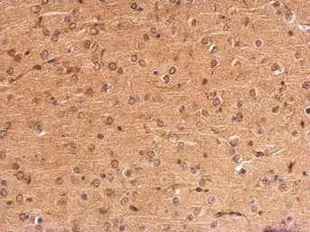 Anti-MC1 Receptor antibody [C2C3], C-term used in IHC (Paraffin sections) (IHC-P). GTX108190
