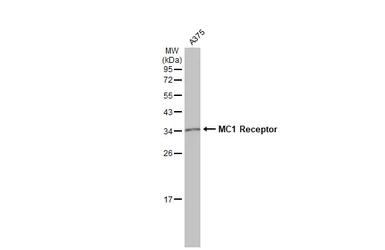 Anti-MC1 Receptor antibody [C2C3], C-term used in Western Blot (WB). GTX108190