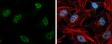 Anti-ROR alpha antibody [C3], C-term used in Immunocytochemistry/ Immunofluorescence (ICC/IF). GTX108201