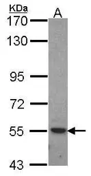 Anti-ROR alpha antibody [C3], C-term used in Western Blot (WB). GTX108201