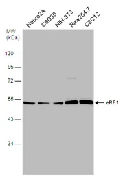 Anti-eRF1 antibody used in Western Blot (WB). GTX108271