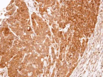 Anti-eRF1 antibody used in IHC (Paraffin sections) (IHC-P). GTX108271