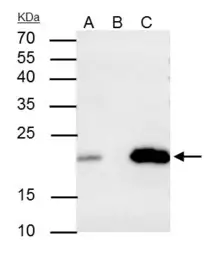 Anti-Caveolin 2 antibody used in Immunoprecipitation (IP). GTX108294