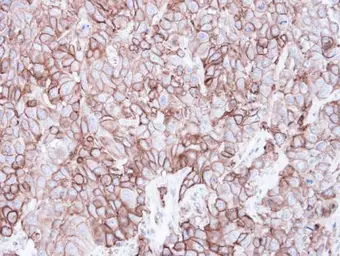 Anti-Caveolin 2 antibody used in IHC (Paraffin sections) (IHC-P). GTX108294