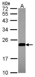 Anti-Caveolin 2 antibody used in Western Blot (WB). GTX108294