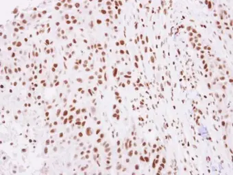 Anti-Histone H2A.Z antibody used in IHC (Paraffin sections) (IHC-P). GTX108298