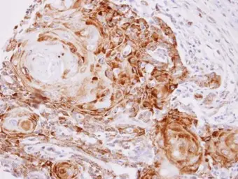 Anti-CDK5 antibody [C2C3], C-term used in IHC (Paraffin sections) (IHC-P). GTX108328