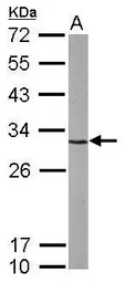 Anti-CDK5 antibody [C2C3], C-term used in Western Blot (WB). GTX108328