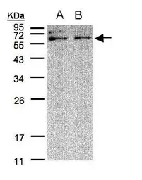 Anti-XYLB antibody [C3], C-term used in Western Blot (WB). GTX108336