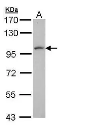 Anti-LUZP1 antibody [N1], N-term used in Western Blot (WB). GTX108352