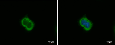 Anti-MIG antibody used in Immunocytochemistry/ Immunofluorescence (ICC/IF). GTX108422