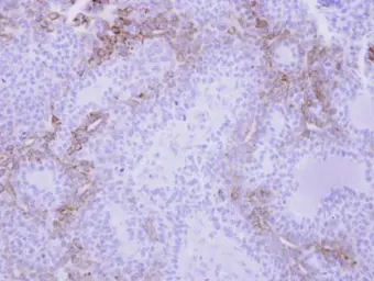 Anti-MIG antibody used in IHC (Paraffin sections) (IHC-P). GTX108422