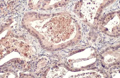 Anti-MIG antibody used in IHC (Paraffin sections) (IHC-P). GTX108422