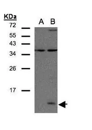 Anti-CCL14 antibody used in Western Blot (WB). GTX108428