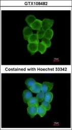 Anti-CHRND antibody [C3], C-term used in Immunocytochemistry/ Immunofluorescence (ICC/IF). GTX108482