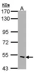 Anti-CHRND antibody [C3], C-term used in Western Blot (WB). GTX108482