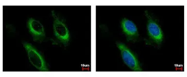 Anti-IL2 Receptor beta antibody [C3], C-term used in Immunocytochemistry/ Immunofluorescence (ICC/IF). GTX108495