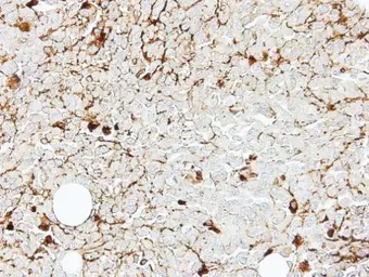 Anti-IL2 Receptor beta antibody [C3], C-term used in IHC (Paraffin sections) (IHC-P). GTX108495