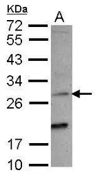 Anti-NKG2C antibody [N1N2], N-term used in Western Blot (WB). GTX108500