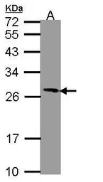 Anti-PGRMC1 antibody [C2C3], C-term used in Western Blot (WB). GTX108532