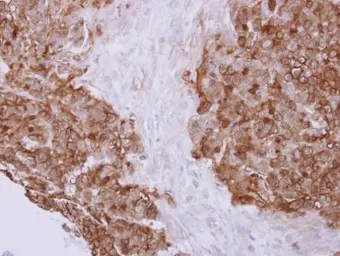 Anti-Profilin 2 antibody used in IHC (Paraffin sections) (IHC-P). GTX108589